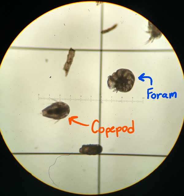 Copepod and foram in microscope.