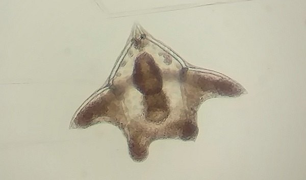 Echinoderm larva