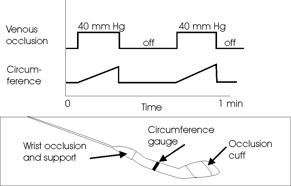 Limb plethysmography