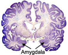 amygdala