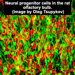 neural 
progenitor cells