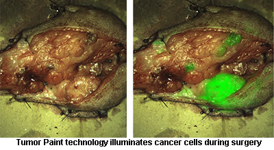 tumor paint