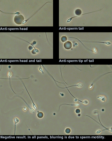 Immunobeads 23507