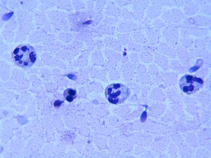 round cells in sperm