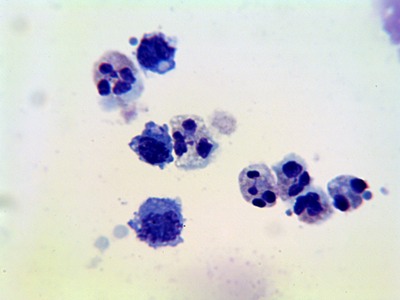 round cells in sperm