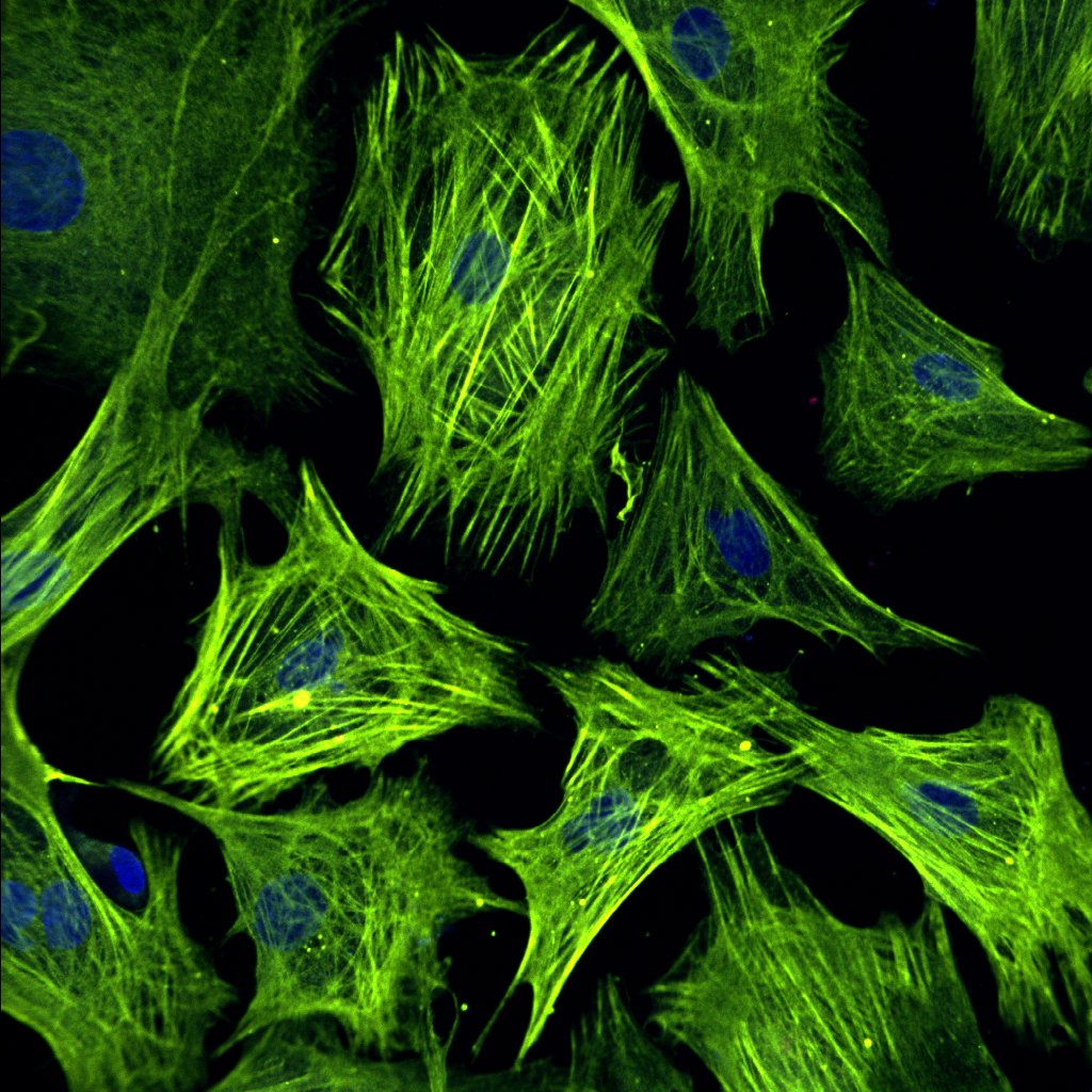 Intercepting fibrotic networks for cardiac regeneration