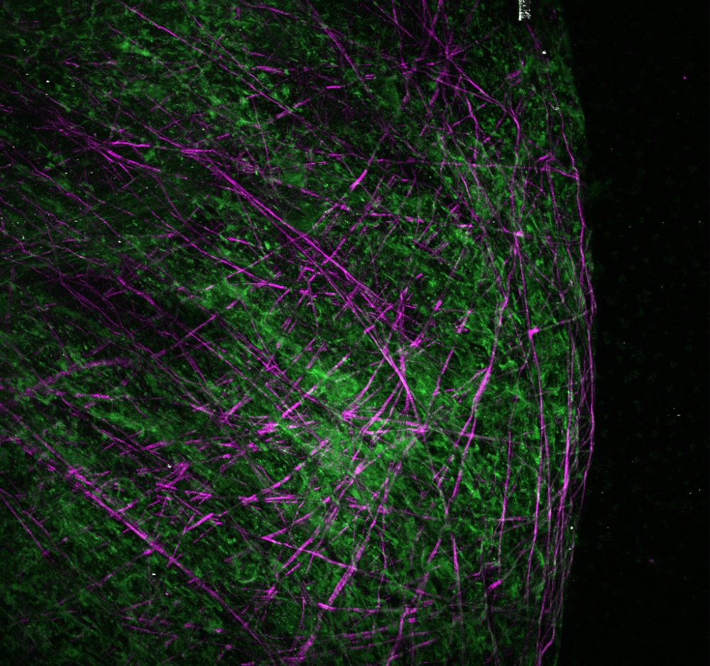 Uncovering the mechanical underpinnings of cardiac remodeling