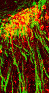 Dextran-injected and TuJ1-stained trigeminal neurons.