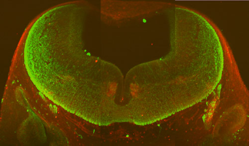 Islet-1- and TuJ1-stained hindbrain.