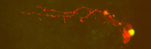 FITC- and neurobiotin-filled neuron.