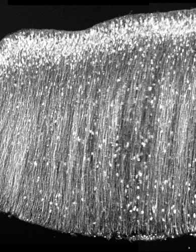 T-Type Calcium Channel staining