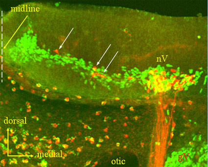 Retrograde labeling of hindbrain branchiomeric motor neurons of the trigeminal nerve.