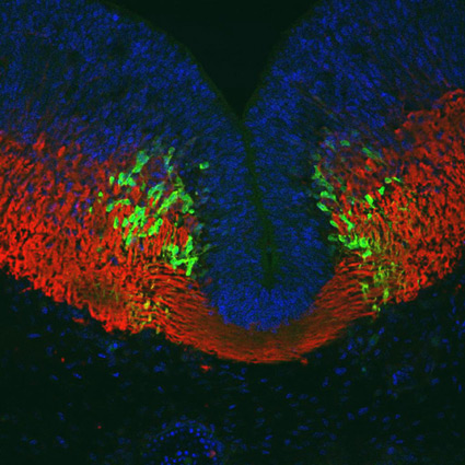 DAPI-, TuJ1-, and serotonin-stained neurons.