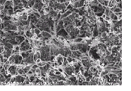 SEM images of CNT nanocomposite.