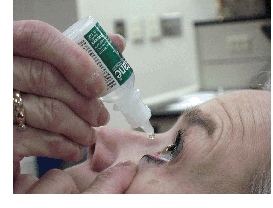 image of a woman putting in eyedrops
