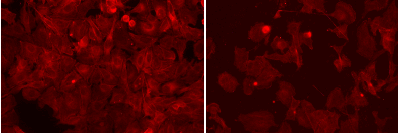 image of a microscopic slide showing red stained cells against a black background