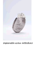 image of an implantable cardiac defibrillator