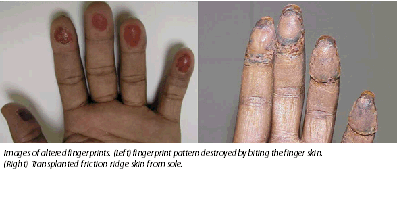 image of finger prints melted off and altered by cutting