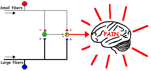 gate control theory of pain diagram