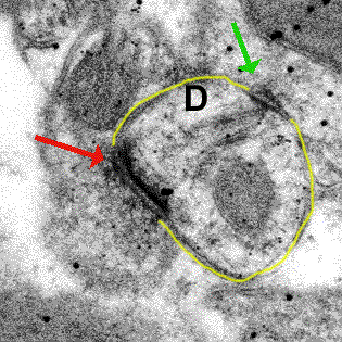 A high magnification image of synapse obtained by electron microscopy