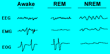 stages of nrem