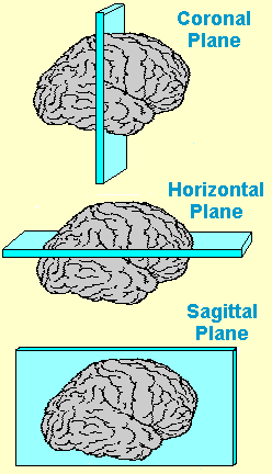 sagittal cut of brain