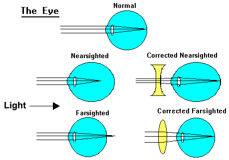 Neuroscience For Kids - Glasses myopia hyperopia diagrams 