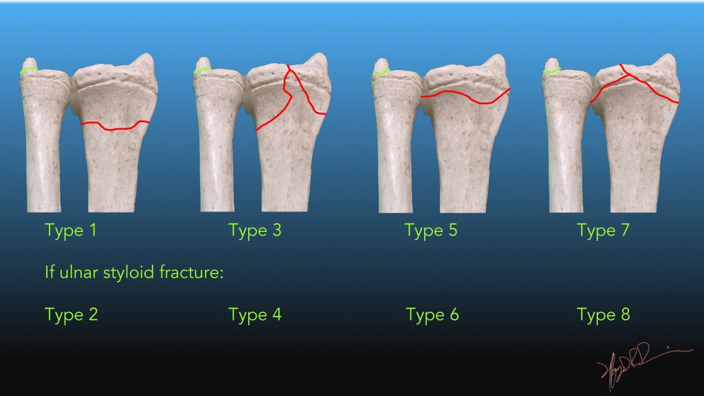 does radial head fracture cause wrist pain