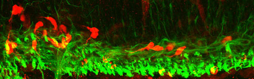 Dextran-injected and TuJ1-stained trigeminal motor neurons.
