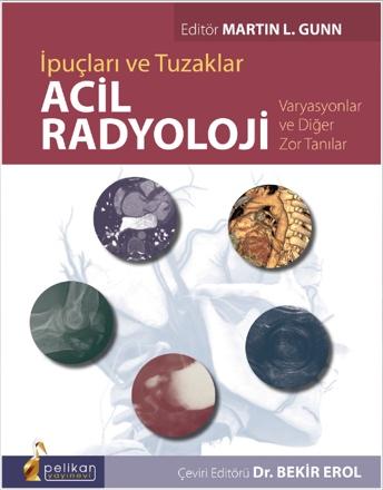 https://www.cesurozturkkitaplari.com/u/cesur/img/c/a/c/acil-radyoloji54dbb1a86f1c3b9c32431484de5eac6f.jpg