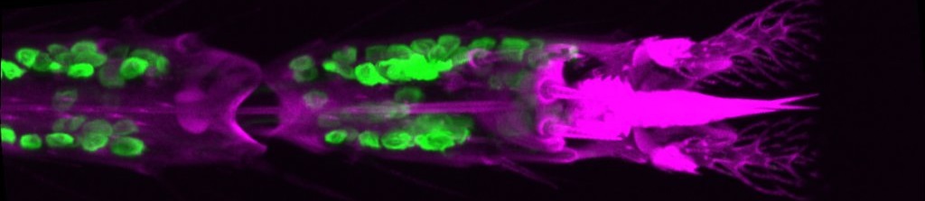 sensory neurons (green) in the fly foot(magenta)
